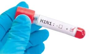 H1N1